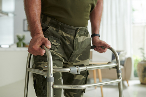 DVA Permanent Impairment Compensation Guide 2025